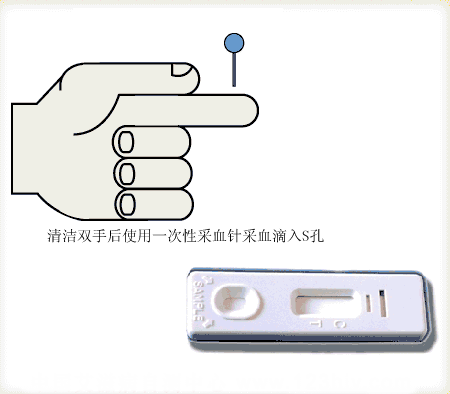 艾滋病试纸操作演示图